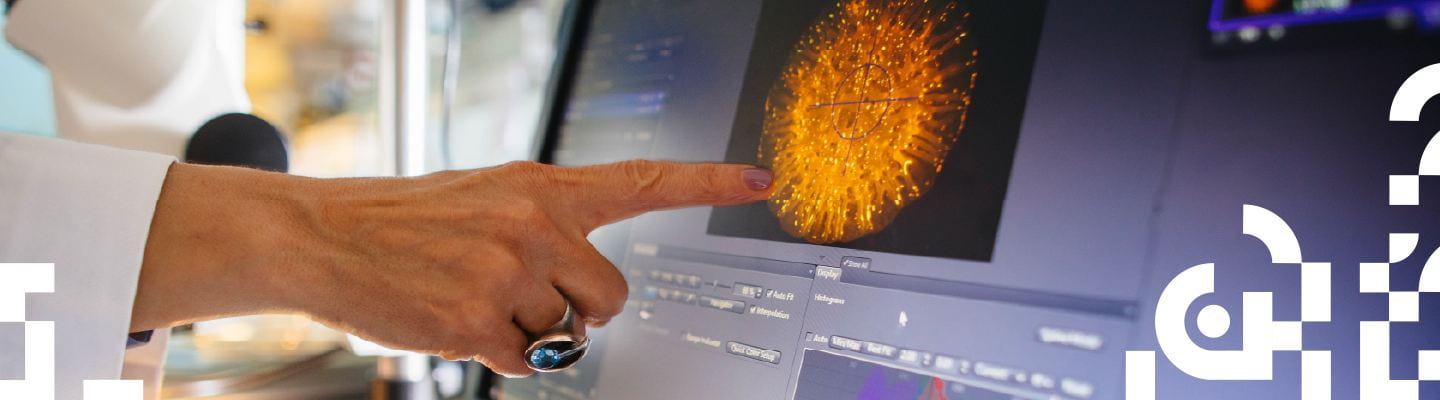 Finger of person in lab coat  pointing towards image on computer. Finger has nail polish and a ring. 